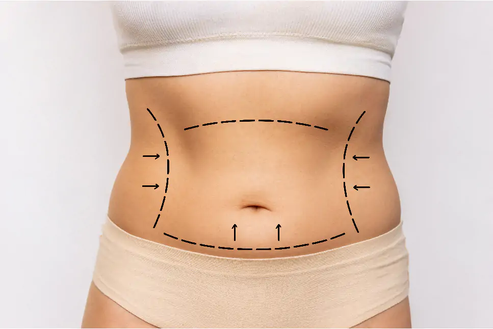 360 Lipo